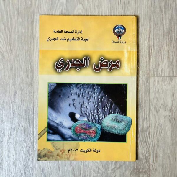مرض الجدري