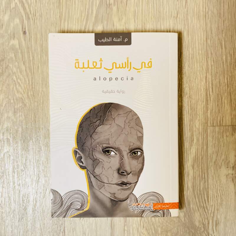 في رأسي ثعلبة